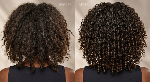 Eden Hair Restoration System