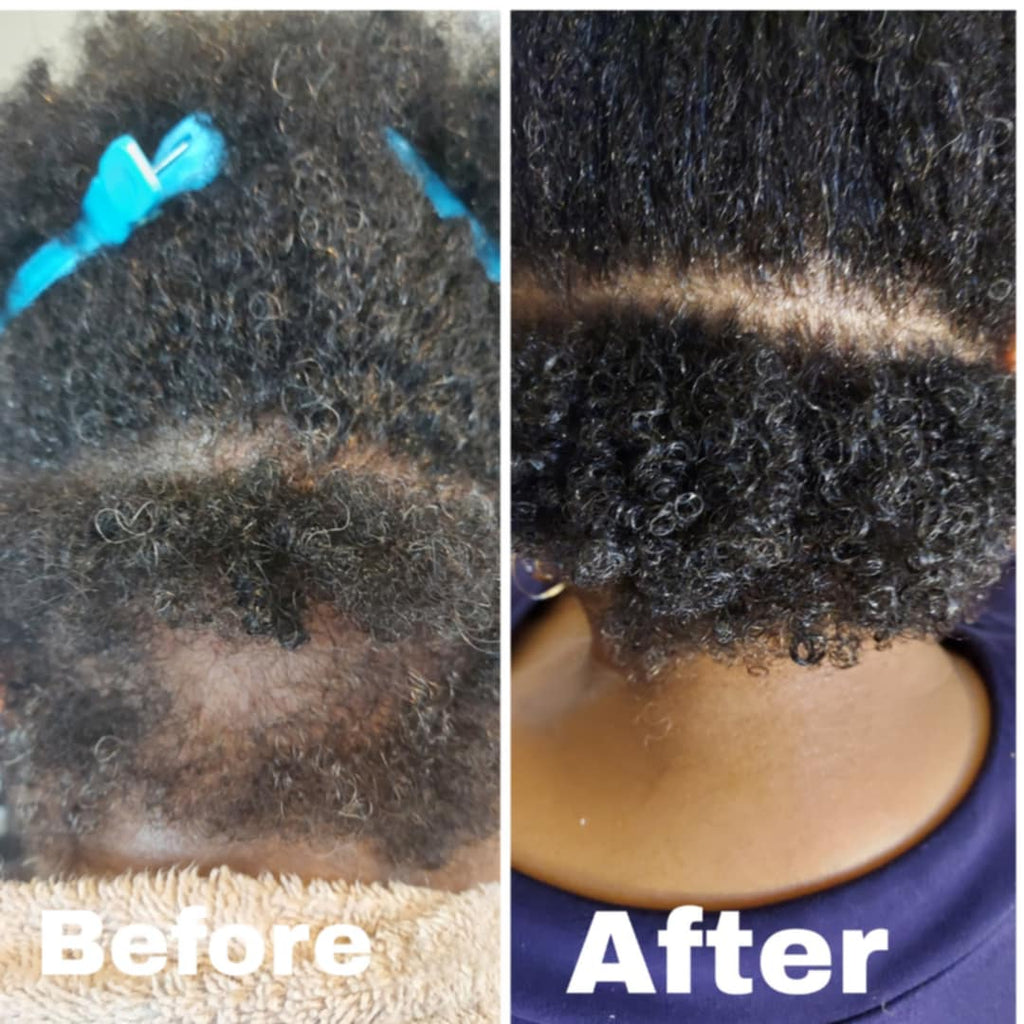 Scalp Recovery Rosemary Growth Serum