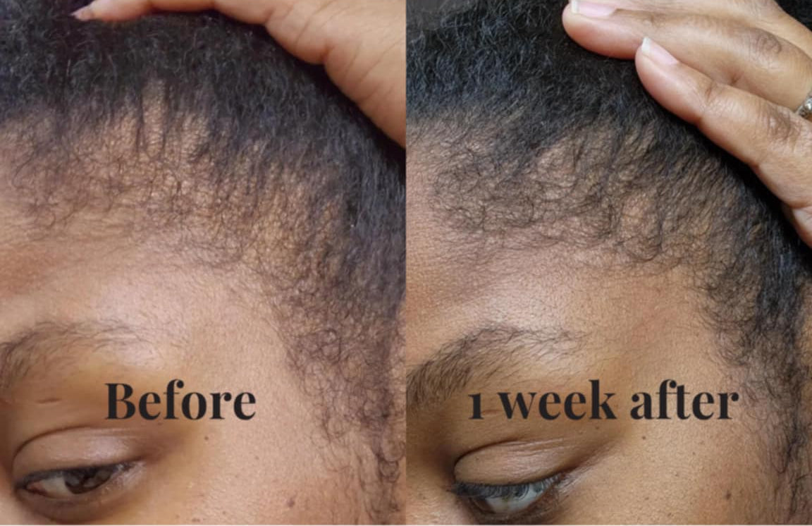 Scalp Recovery Rosemary Growth Serum