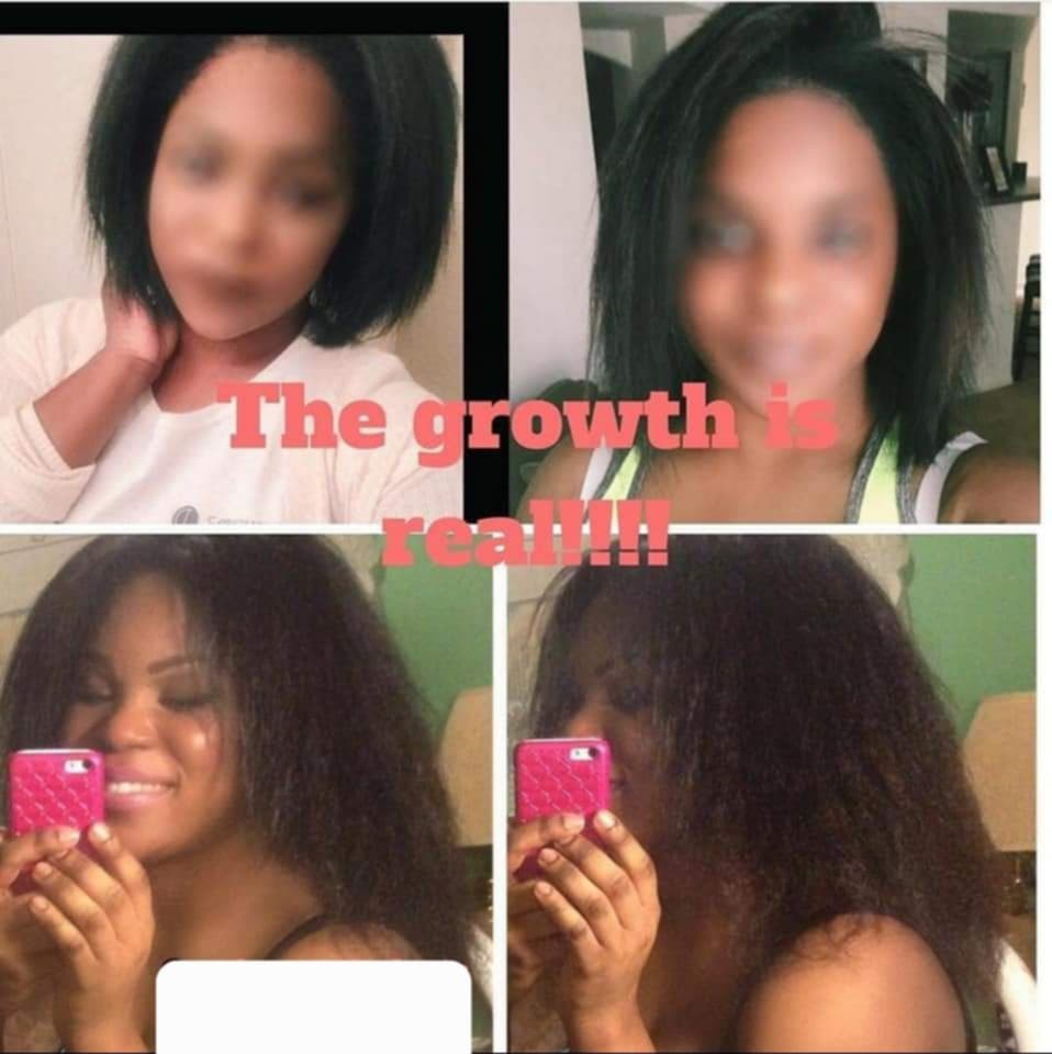 Eden Hair Restoration System – Breakage Protection From Wash to Styling
