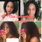 Eden Hair Restoration System – Breakage Protection From Wash to Styling